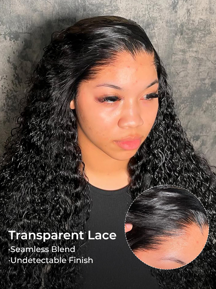 m-shaped hairline with widow's peak