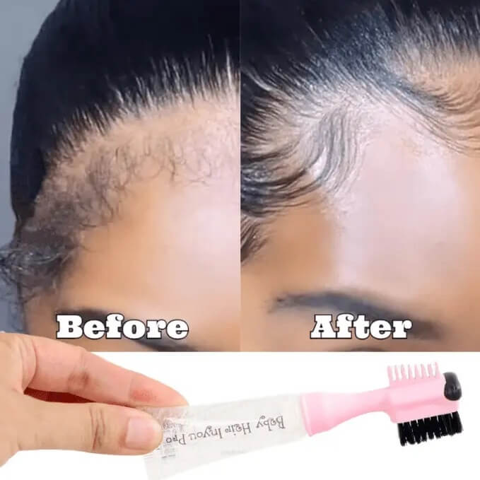 neat and natural hairline