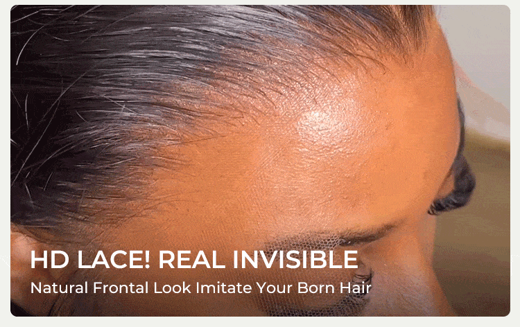 lace wig